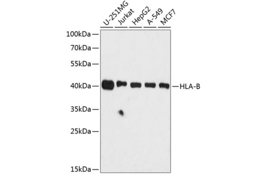 Western Blot - Anti-HLA Class 1 ABC Antibody (A8902) - Antibodies.com