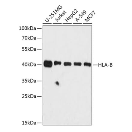 Western Blot - Anti-HLA Class 1 ABC Antibody (A8902) - Antibodies.com