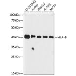 Western Blot - Anti-HLA Class 1 ABC Antibody (A8902) - Antibodies.com