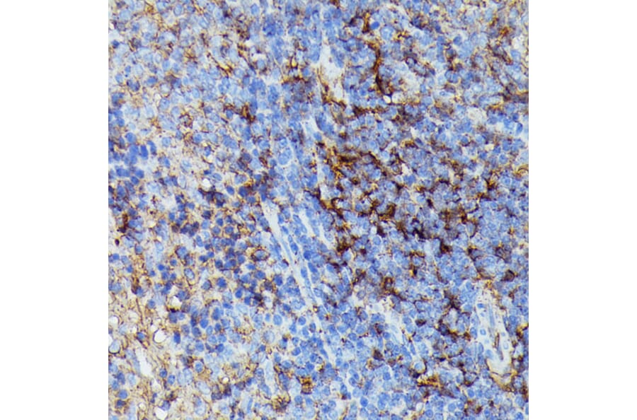 Immunohistochemistry - Anti-HLA Class 1 ABC Antibody (A8902) - Antibodies.com