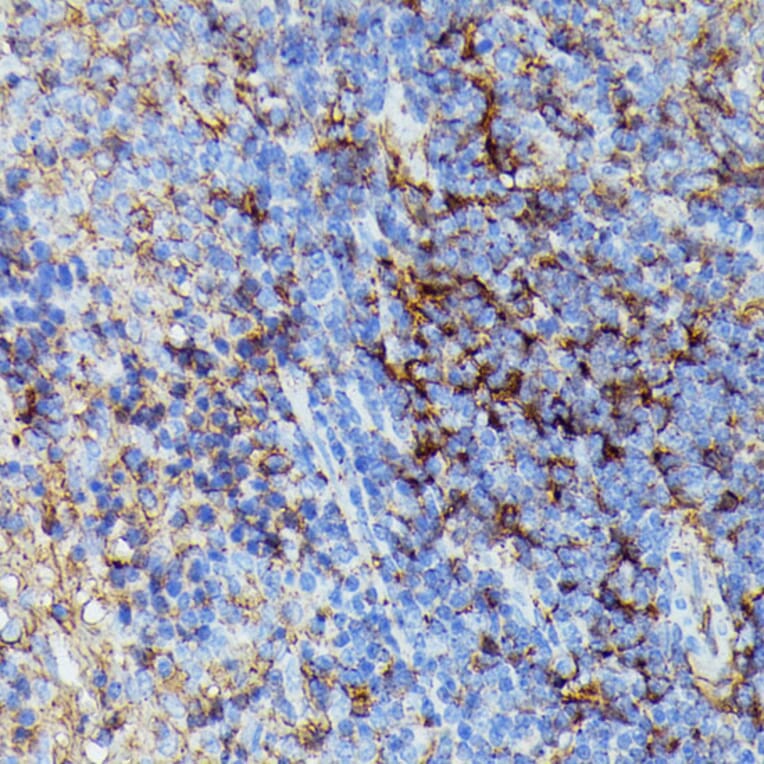 Immunohistochemistry - Anti-HLA Class 1 ABC Antibody (A8902) - Antibodies.com