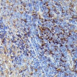 Immunohistochemistry - Anti-HLA Class 1 ABC Antibody (A8902) - Antibodies.com