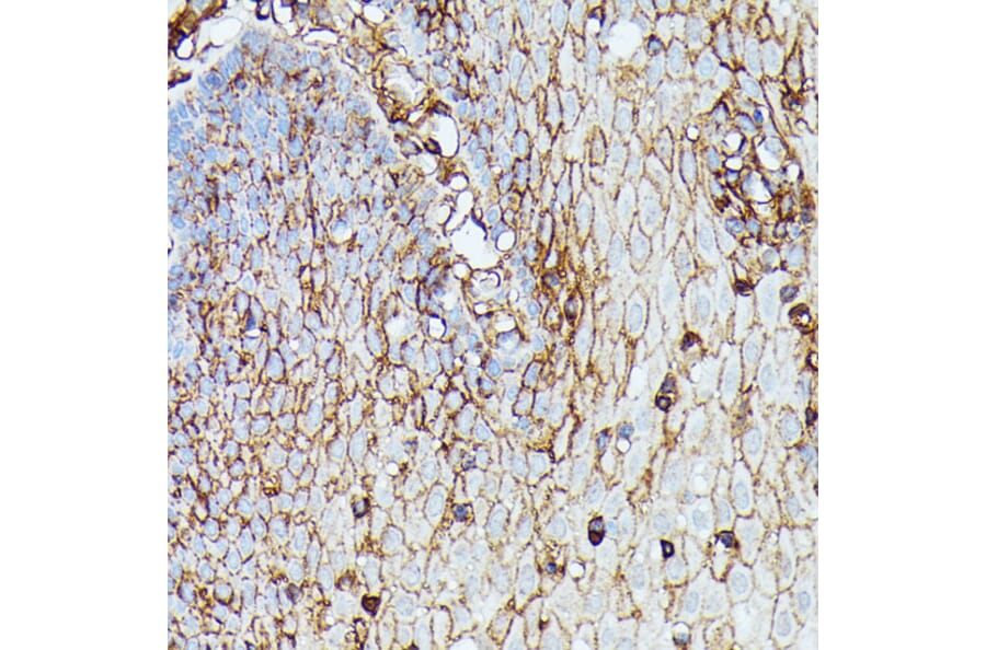 Immunohistochemistry - Anti-HLA Class 1 ABC Antibody (A8902) - Antibodies.com