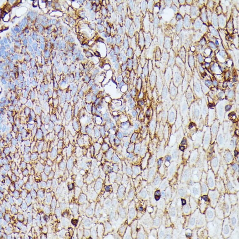 Immunohistochemistry - Anti-HLA Class 1 ABC Antibody (A8902) - Antibodies.com