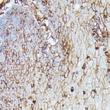 Immunohistochemistry - Anti-HLA Class 1 ABC Antibody (A8902) - Antibodies.com