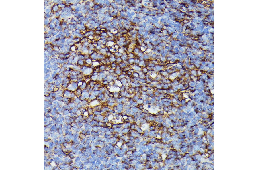 Immunohistochemistry - Anti-HLA Class 1 ABC Antibody (A8902) - Antibodies.com