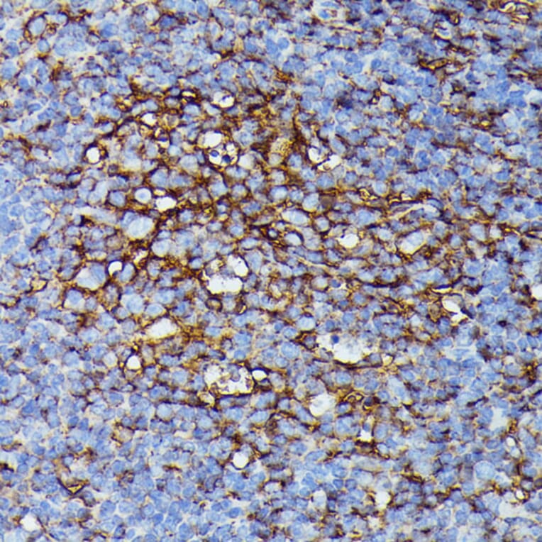 Immunohistochemistry - Anti-HLA Class 1 ABC Antibody (A8902) - Antibodies.com