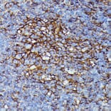 Immunohistochemistry - Anti-HLA Class 1 ABC Antibody (A8902) - Antibodies.com