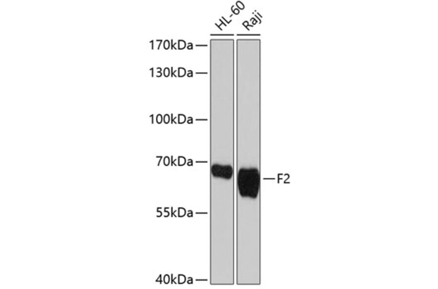 Western Blot - Anti-F2 Antibody (A1290) - Antibodies.com