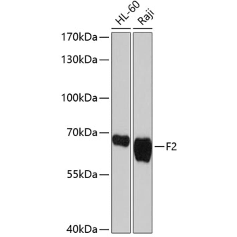 Western Blot - Anti-F2 Antibody (A1290) - Antibodies.com