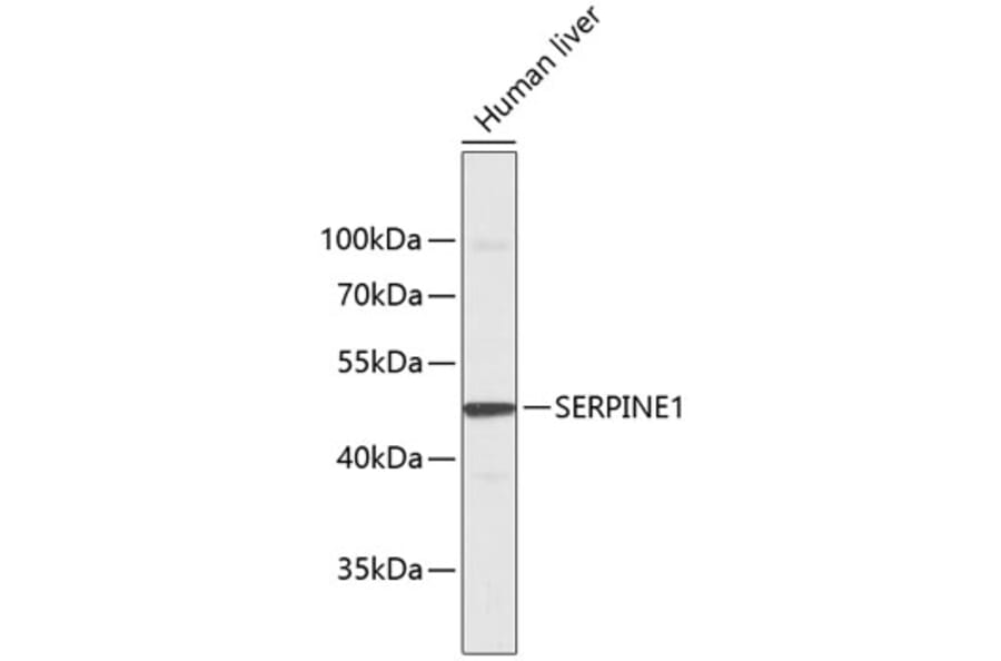 Western Blot - Anti-SERPINE1 Antibody (A1297) - Antibodies.com