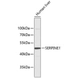 Western Blot - Anti-SERPINE1 Antibody (A1297) - Antibodies.com