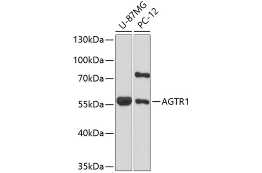 Western Blot - Anti-AGTR1 Antibody (A1313) - Antibodies.com