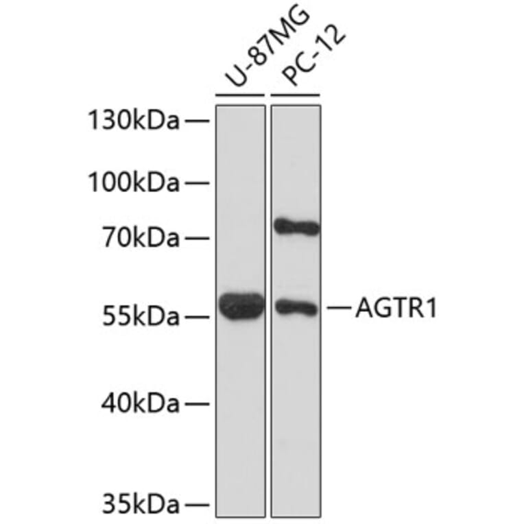Western Blot - Anti-AGTR1 Antibody (A1313) - Antibodies.com