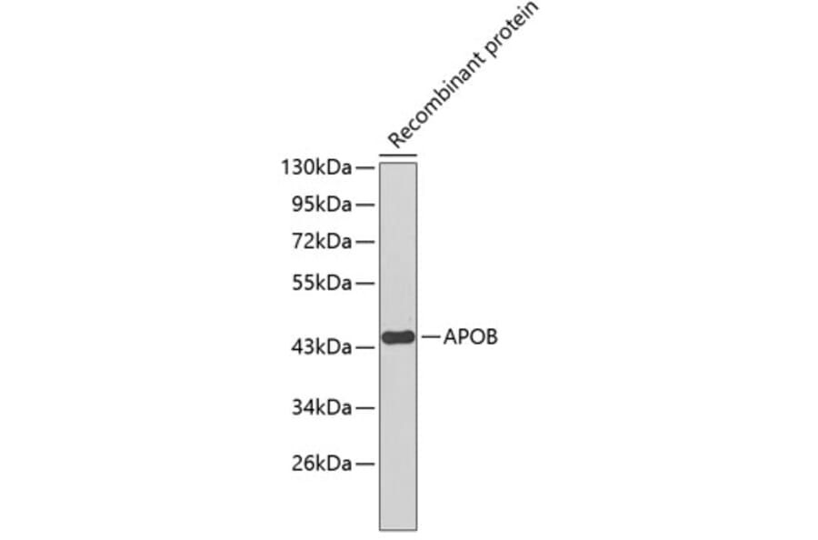 Western Blot - Anti-APOB Antibody (A1329) - Antibodies.com