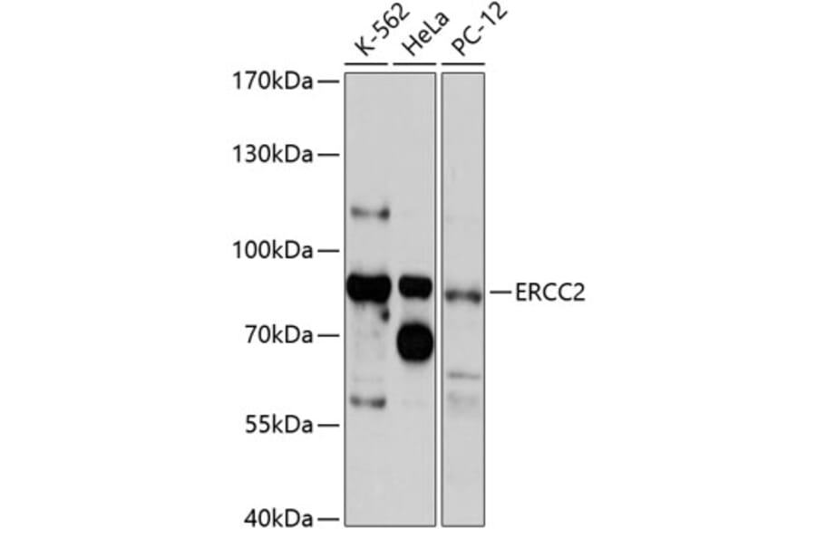 Western Blot - Anti-ERCC2 Antibody (A1332) - Antibodies.com