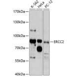 Western Blot - Anti-ERCC2 Antibody (A1332) - Antibodies.com
