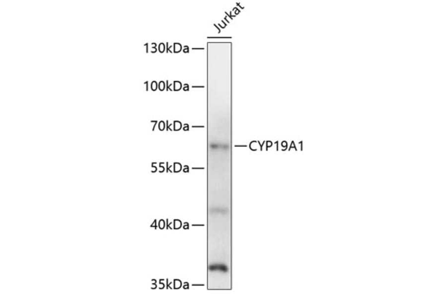 Western Blot - Anti-CYP19A1 Antibody (A1336) - Antibodies.com