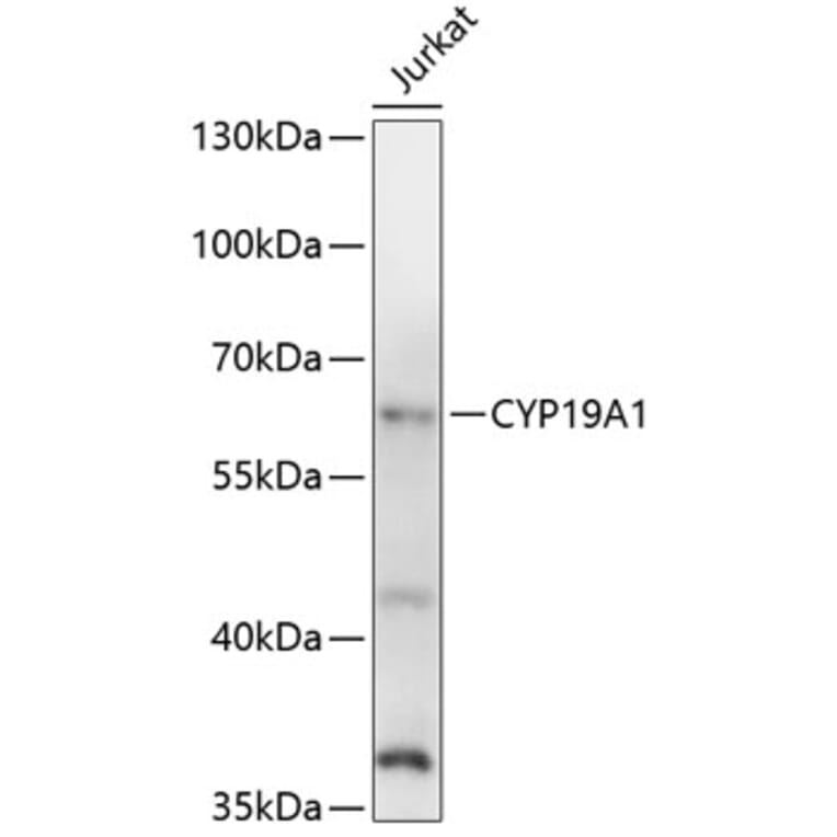 Western Blot - Anti-CYP19A1 Antibody (A1336) - Antibodies.com