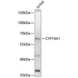 Western Blot - Anti-CYP19A1 Antibody (A1336) - Antibodies.com