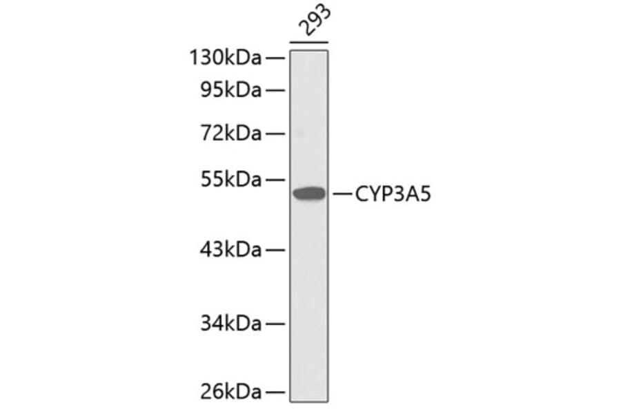 Western Blot - Anti-CYP3A5 Antibody (A1349) - Antibodies.com