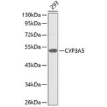 Western Blot - Anti-CYP3A5 Antibody (A1349) - Antibodies.com