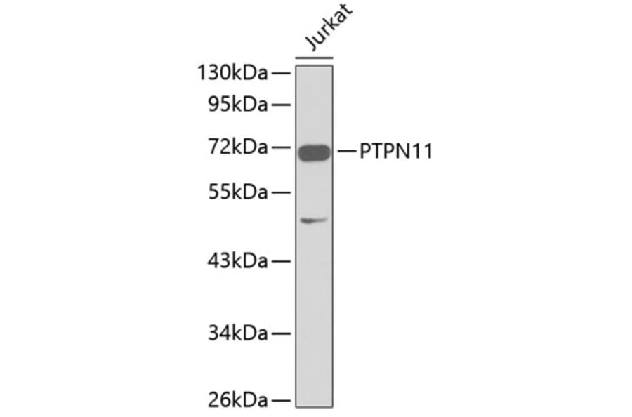 Western Blot - Anti-PTPN11 Antibody (A1356) - Antibodies.com