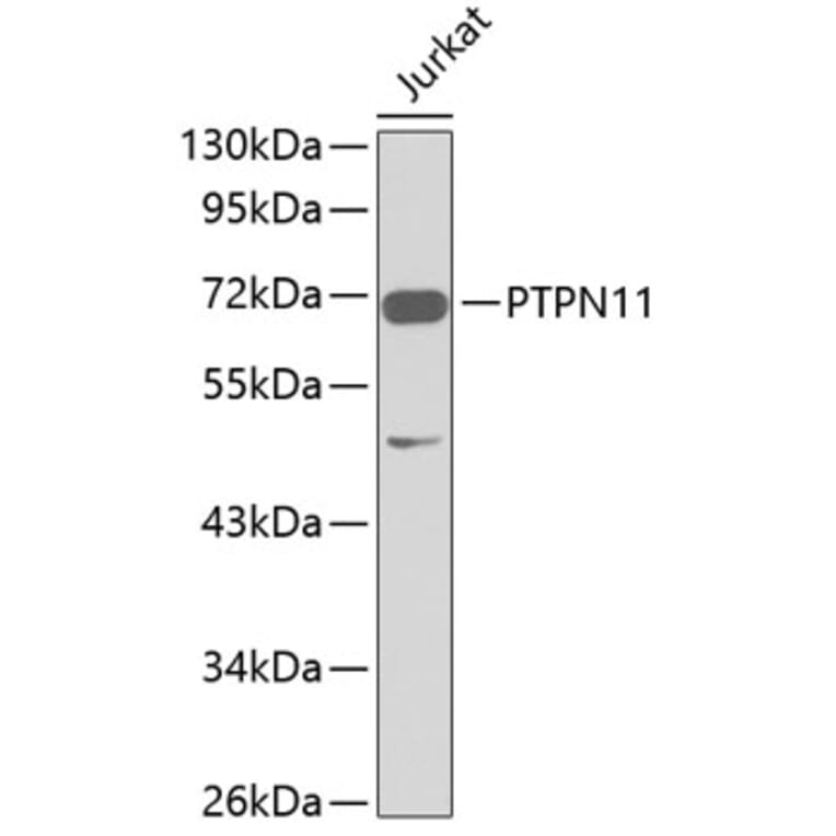 Western Blot - Anti-PTPN11 Antibody (A1356) - Antibodies.com