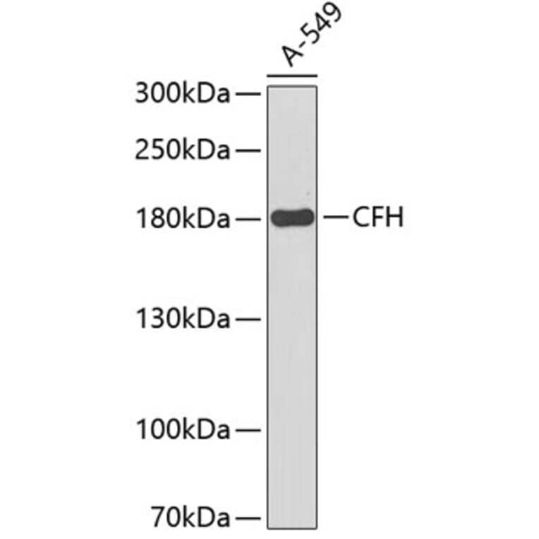 Anti-CFH Antibody (A8914) | Antibodies.com