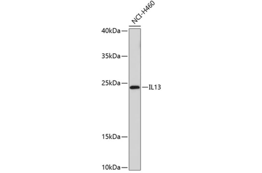 Western Blot - Anti-IL-13 Antibody (A8915) - Antibodies.com
