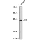 Western Blot - Anti-IL-13 Antibody (A8915) - Antibodies.com