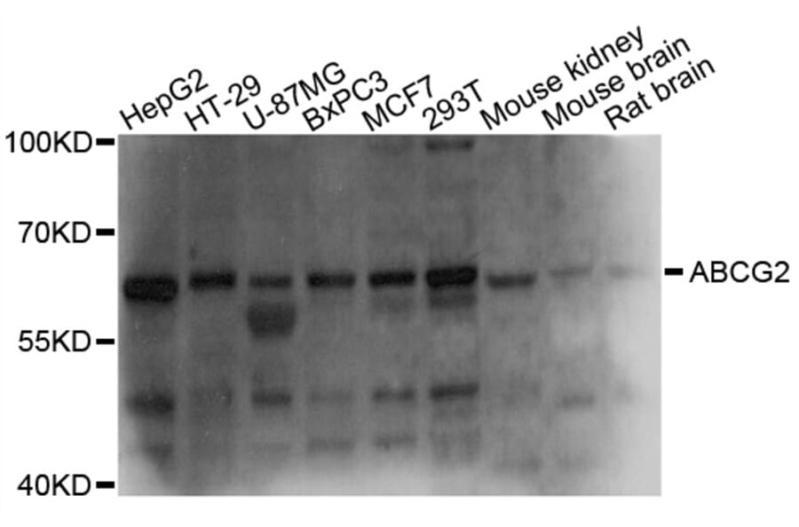 Western Blot - Anti-ABCG2 Antibody (A1370) - Antibodies.com