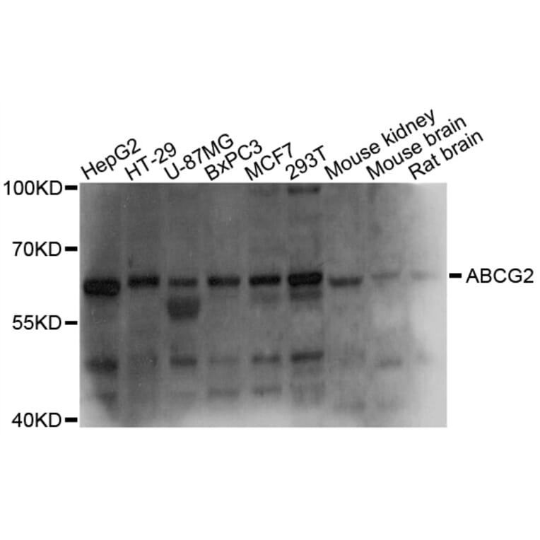 Western Blot - Anti-ABCG2 Antibody (A1370) - Antibodies.com