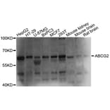 Western Blot - Anti-ABCG2 Antibody (A1370) - Antibodies.com