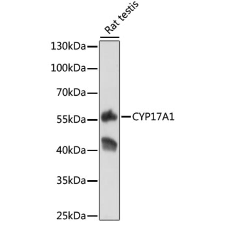 Western Blot - Anti-Cytochrome P450 17A1/CYP17A1 Antibody (A8917) - Antibodies.com