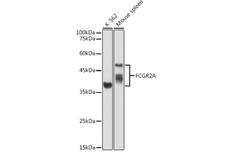 Western Blot - Anti-CD32 Antibody (A8919) - Antibodies.com