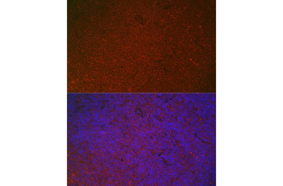 Immunofluorescence - Anti-CD32 Antibody (A8919) - Antibodies.com