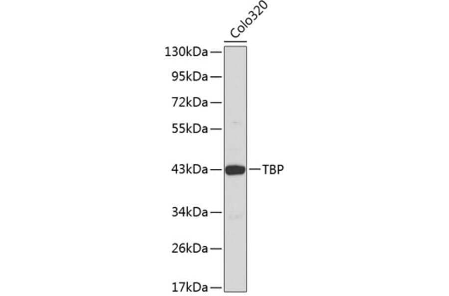 Western Blot - Anti-TBP Antibody (A1423) - Antibodies.com