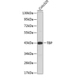 Western Blot - Anti-TBP Antibody (A1423) - Antibodies.com