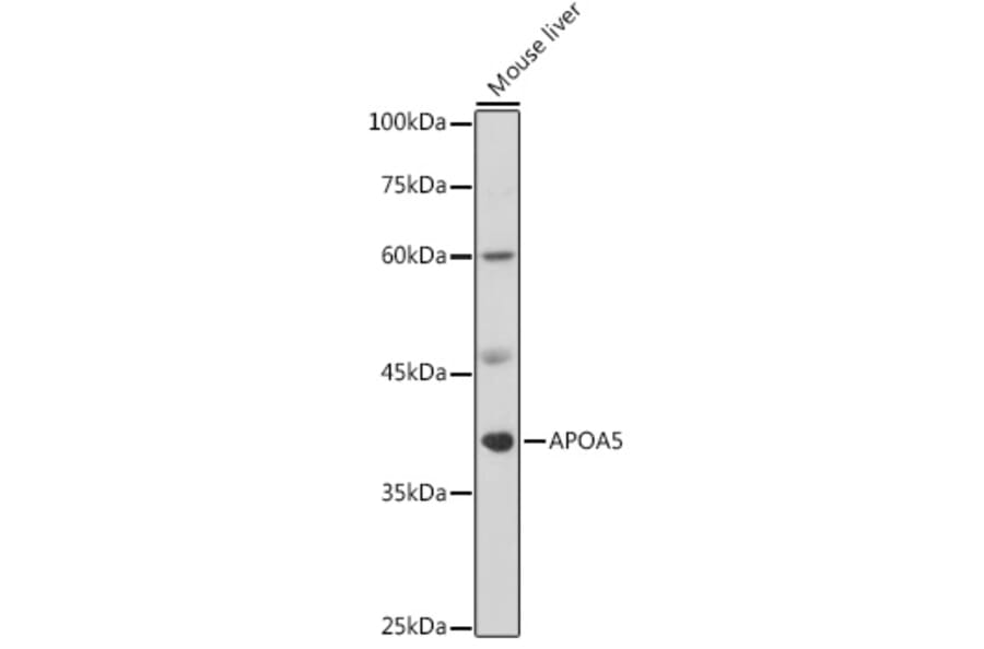 Western Blot - Anti-Apolipoprotein A V/APOA5 Antibody (A8923) - Antibodies.com
