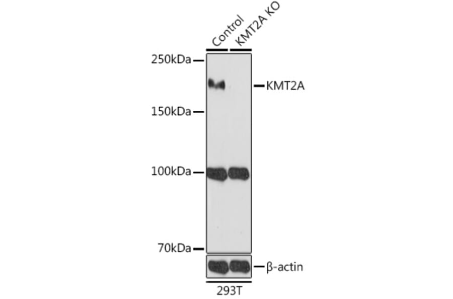 Western Blot - Anti-MLL Antibody (A8925) - Antibodies.com
