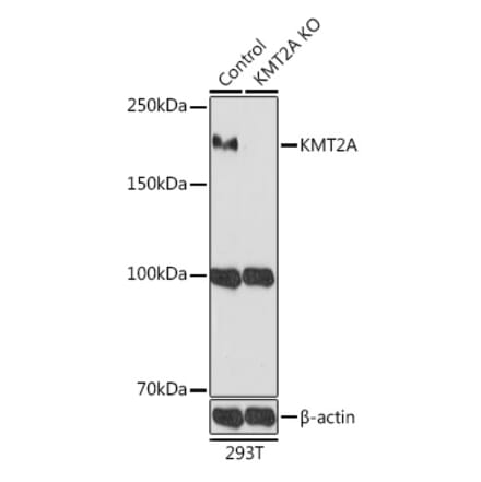 Western Blot - Anti-MLL Antibody (A8925) - Antibodies.com