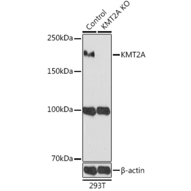 Western Blot - Anti-MLL Antibody (A8925) - Antibodies.com