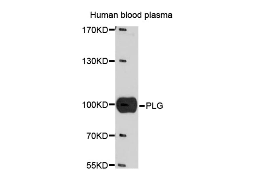Western Blot - Anti-PLG Antibody (A1436) - Antibodies.com