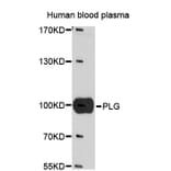 Western Blot - Anti-PLG Antibody (A1436) - Antibodies.com