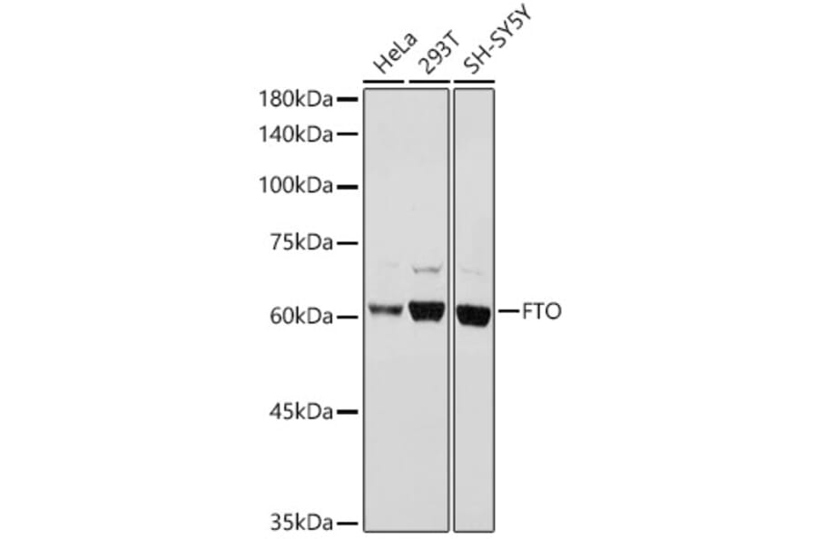 Western Blot - Anti-FTO Antibody (A8927) - Antibodies.com