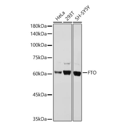 Western Blot - Anti-FTO Antibody (A8927) - Antibodies.com
