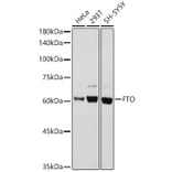 Western Blot - Anti-FTO Antibody (A8927) - Antibodies.com