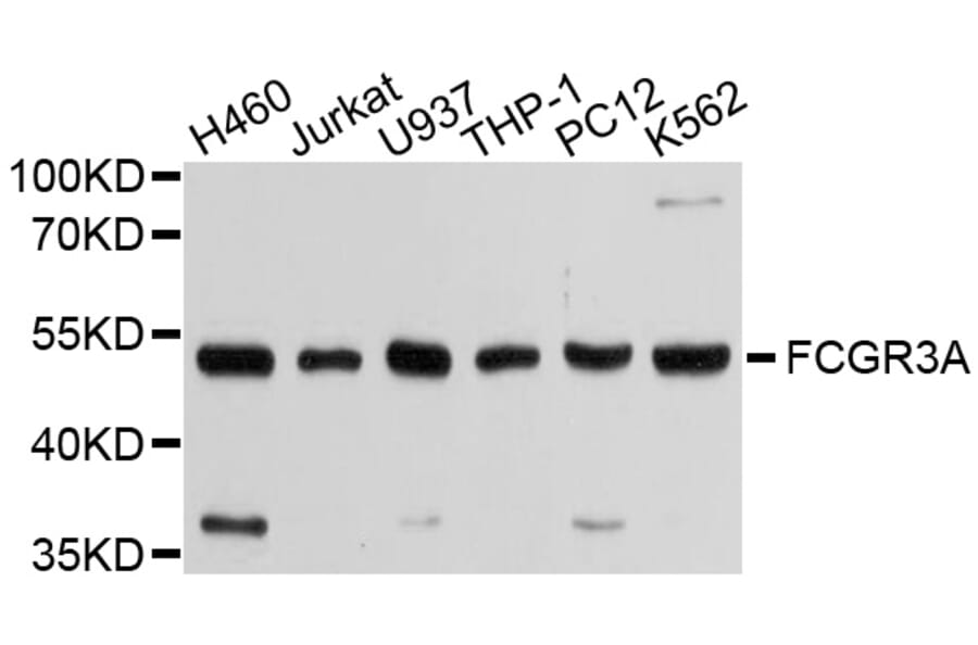 Western Blot - Anti-FCGR3A Antibody (A1441) - Antibodies.com
