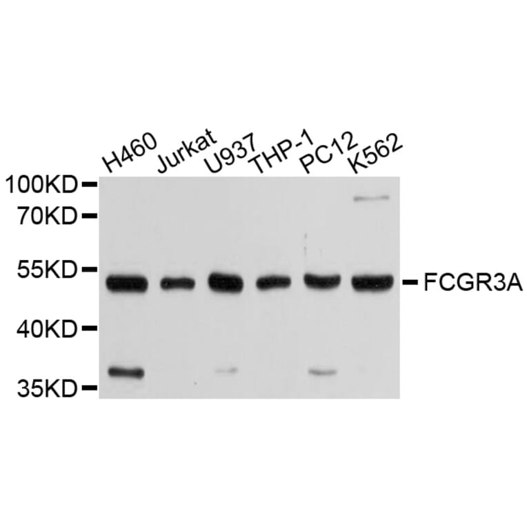 Western Blot - Anti-FCGR3A Antibody (A1441) - Antibodies.com